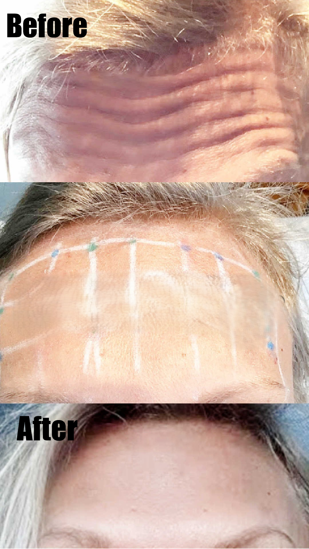 After Treatment